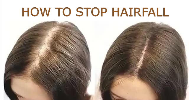 HAIRFALL PREVENTION