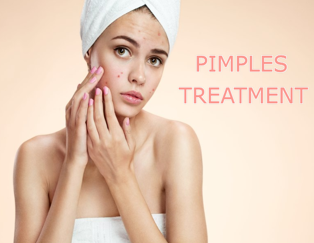 pimples treatment.jpg