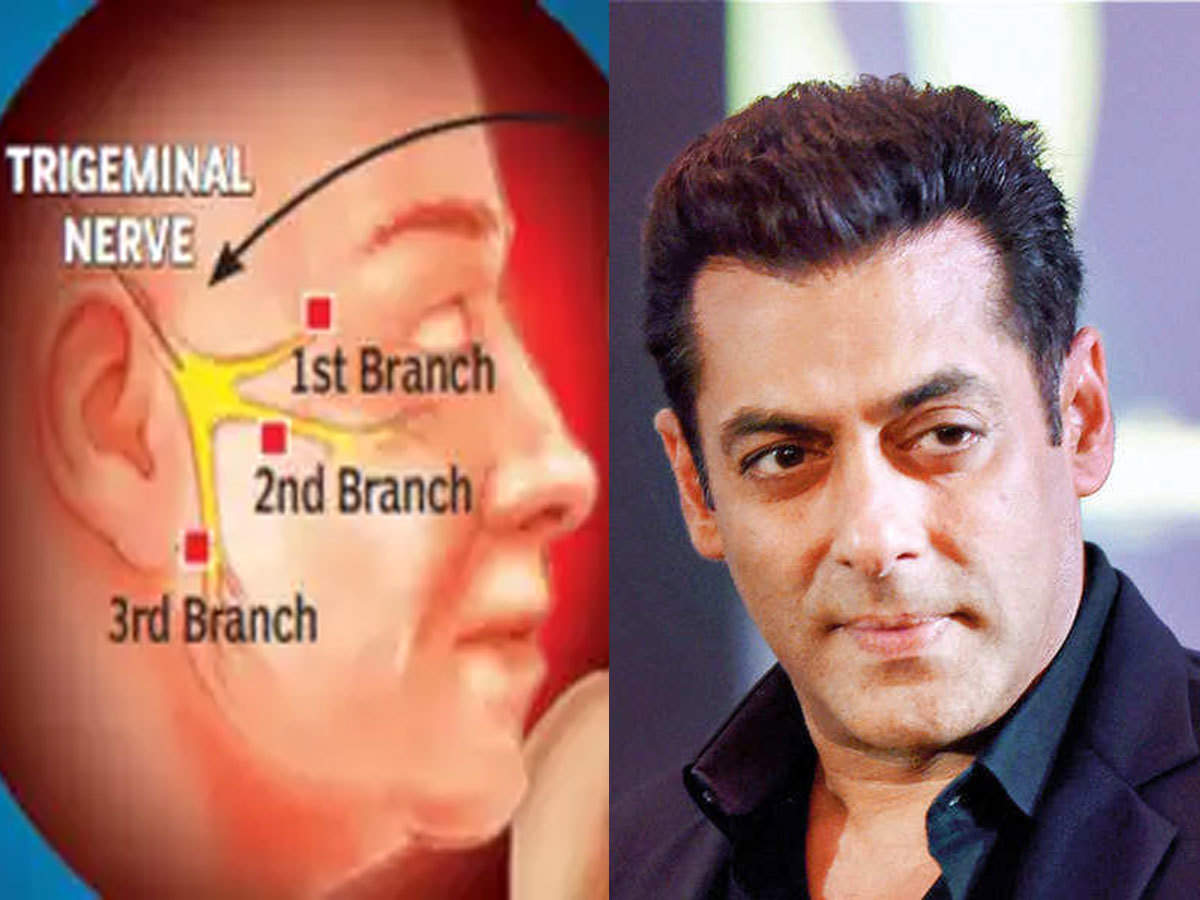 salman khan face disease